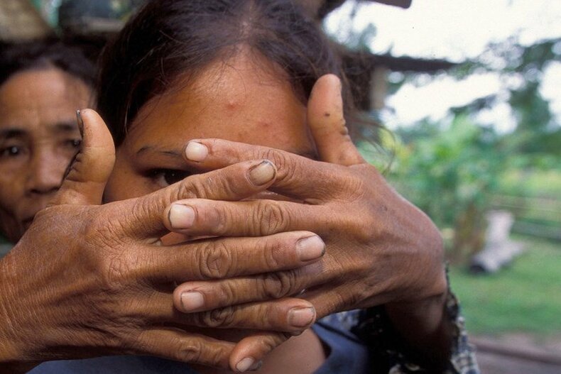 © UNICEF/Jim Holmes © UNICEF/Jim Holmes