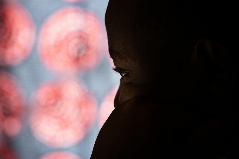 © UNICEF/ UNI472659/ Vigné © UNICEF/ UNI472659/ Vigné
